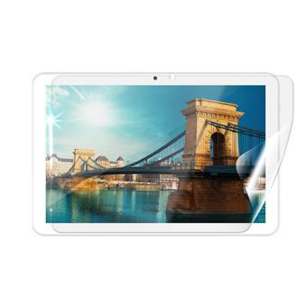 Screenshield IGET Smart W201 fólie na displej